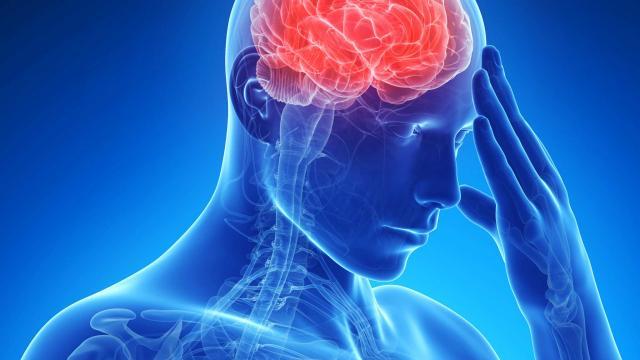 HG16697_QA_brain-headache-migraine_FS