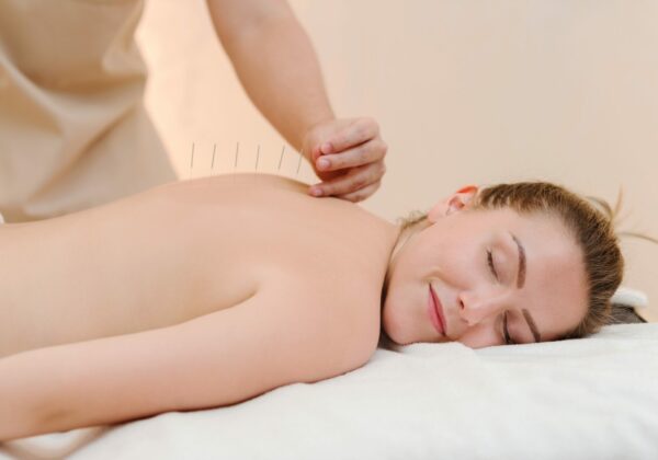Acupuncture by Body Conscious • acupuncture1