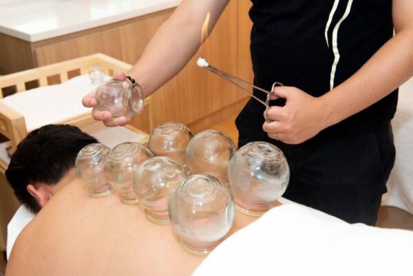 Cupping by Body Conscious • cupping2